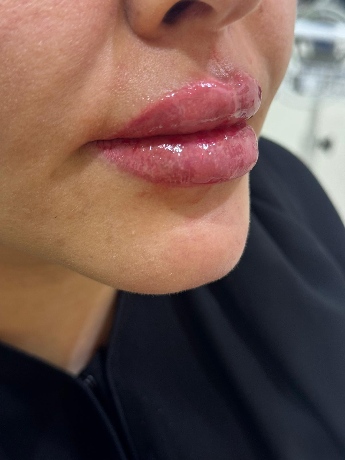 فلير الشفايف