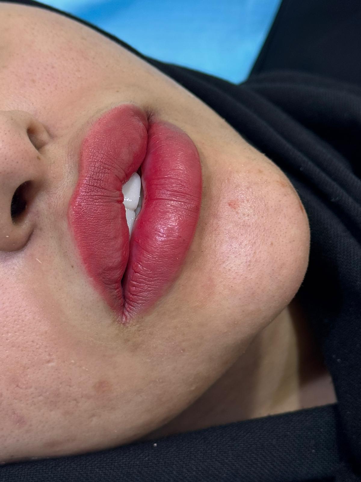 فيلر شفايف 2